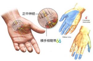 親指～中指のしびれ（手根管症候群）を自分で軽減する「ある方法」